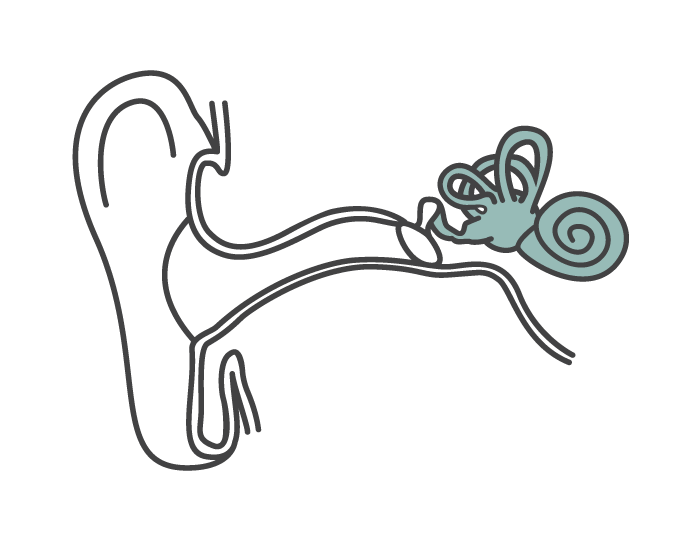 Diagram of an ear highlighting the inner ear where sensorineural hearing loss occurs